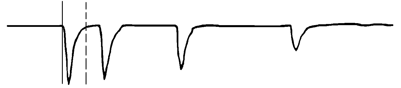 遠端有短接線的波形 遠端有短接線的波形